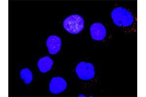 Proximity Ligation Analysis of protein-protein interactions between PTK2B and YES1.