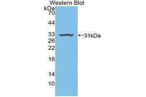 Western Blotting (WB) image for anti-Plasminogen (PLG) (AA 191-433) antibody (ABIN3207024) (PLG anticorps  (AA 191-433))