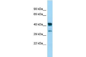 WB Suggested Anti-CHID1 Antibody Titration: 1. (CHID1 anticorps  (N-Term))