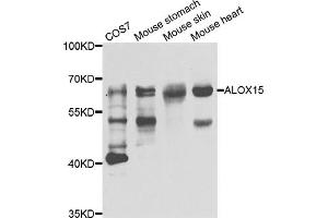 Western blot analysis of extracts of various cell lines, using ALOX15 antibody (ABIN5975430) at 1/1000 dilution. (ALOX15 anticorps)