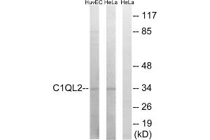 Western blot analysis of extracts from HUVEC cells and HeLa cells, using C1QL2 antibody.