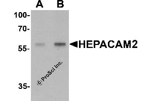 Western Blotting (WB) image for anti-HEPACAM Family Member 2 (HEPACAM2) (C-Term) antibody (ABIN1077405) (HEPACAM2 anticorps  (C-Term))
