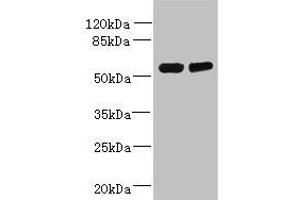 Western blot All lanes: TCTE1 antibody at 3 μg/mL Lane 1: U251 whole cell lysate Lane 2: Mouse brain tissue Secondary Goat polyclonal to rabbit IgG at 1/10000 dilution Predicted band size: 56 kDa Observed band size: 56 kDa