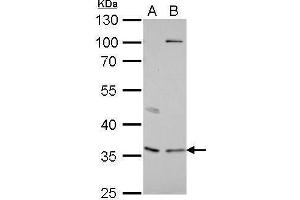 WB Image Decorin antibody detects DCN protein by Western blot analysis. (Decorin anticorps)