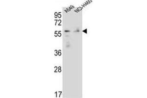 Western Blotting (WB) image for anti-Forkhead Box N1 (FOXN1) antibody (ABIN2996514)