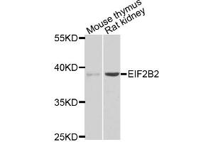 Western blot analysis of extracts of mouse thymus and rat kidney tissues, using EIF2B2 antibody. (EIF2B2 anticorps)