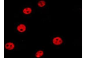 ABIN6277203 staining HepG2 by IF/ICC. (Histone 3 anticorps  (H3K36me3))