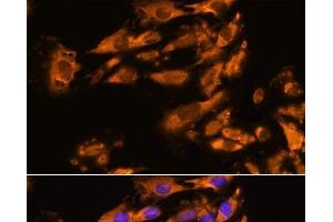 Immunofluorescence analysis of C6 cells using ASPM Polyclonal Antibody at dilution of 1:100.