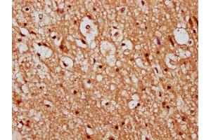 IHC image of ABIN7147330 diluted at 1:300 and staining in paraffin-embedded human brain tissue performed on a Leica BondTM system.