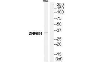 Western blot analysis of extracts from HeLa cells, using ZNF691 antibody. (ZNF691 anticorps)