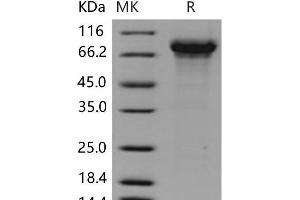 Western Blotting (WB) image for Kininogen 1 (KNG1) (Active) protein (His tag) (ABIN7196714) (KNG1 Protein (His tag))