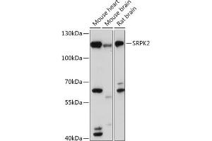 Western blot analysis of extracts of various cell lines, using SRPK2 antibody (ABIN7270269) at 1:1000 dilution. (SRPK2 anticorps  (AA 420-520))
