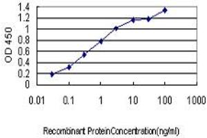 Detection limit for recombinant GST tagged CYorf15B is approximately 0. (CYorf15B anticorps  (AA 82-180))