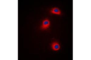 Immunofluorescent analysis of CaMK1 alpha (pT177) staining in Jurkat cells.