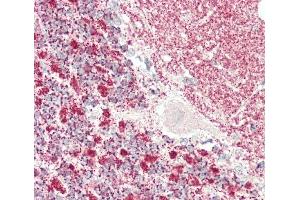 Formalin-fixed and paraffin-embedded H.