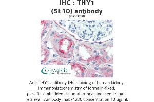 Image no. 1 for anti-CD90 (THY1) antibody (ABIN1724058) (CD90 anticorps)