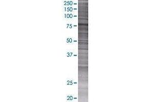 FEM1A transfected lysate.