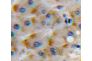 Used in DAB staining on fromalin fixed paraffin-embedded Liver tissue