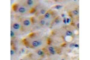 Used in DAB staining on fromalin fixed paraffin-embedded Liver tissue (CSF1R anticorps  (AA 768-928))