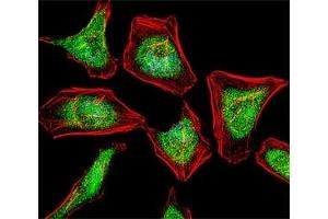 Fluorescent confocal image of HeLa cell stained with ATF7 antibody at 1:25.