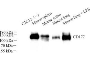 Western blot analysis of CD177 (ABIN7073372)at dilution of 1: 1000 (CD177 anticorps)