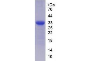 SDS-PAGE analysis of Human ST14 Protein.
