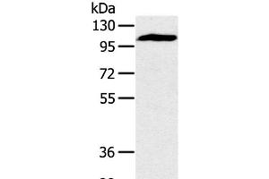 Western Blot analysis of Mouse heart tissue using PYGM Polyclonal Antibody at dilution of 1:400 (PYGM anticorps)