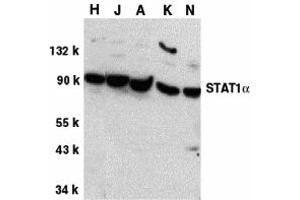 Western Blotting (WB) image for anti-Signal Transducer and Activator of Transcription 1, 91kDa (STAT1) (C-Term) antibody (ABIN1030701) (STAT1 anticorps  (C-Term))