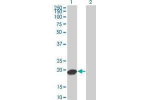 Western Blot analysis of UBE2C expression in transfected 293T cell line by UBE2C monoclonal antibody (M04), clone 3B1. (UBE2C anticorps  (AA 1-179))