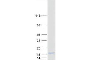 Validation with Western Blot