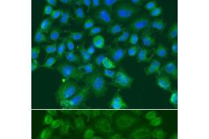 Immunofluorescence analysis of A549 cells using CST1 Polyclonal Antibody (CST1 anticorps)