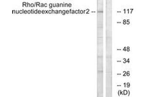 Western blot analysis of extracts from NIH-3T3 cells, using Rho/Rac Guanine Nucleotide Exchange Factor 2 (Ab-885) Antibody. (ARHGEF2 anticorps  (AA 851-900))