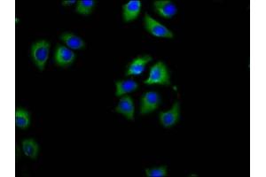 Immunofluorescence staining of A549 cells with ABIN7158492 at 1:100, counter-stained with DAPI.