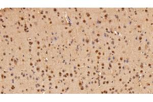 Detection of ADRM1 in Rat Cerebrum Tissue using Polyclonal Antibody to Adhesion Regulating Molecule 1 (ADRM1) (ADRM1 anticorps  (AA 2-407))