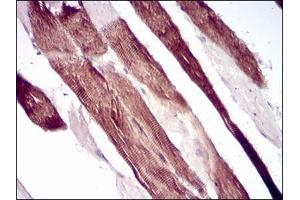 Immunohistochemical analysis of paraffin-embedded muscle tissues using VIL1 mouse mAb with DAB staining. (Villin 1 anticorps  (AA 1-209))