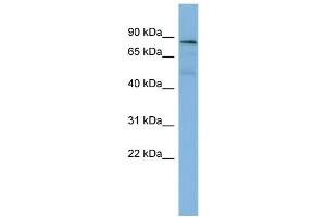 WB Suggested Anti-PTPN12  Antibody Titration: 0. (PTPN12 anticorps  (Middle Region))