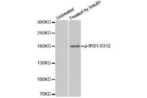 Western blot analysis of extract from 293 cells, using phospho-IRS1-S312 antibody (ABIN2987536). (IRS1 anticorps  (pSer312))