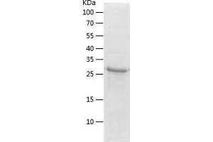 Western Blotting (WB) image for Zinc Finger Protein 8 (ZNF8) (AA 239-520) protein (His-IF2DI Tag) (ABIN7125803)
