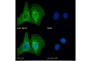 (ABIN571175) Immunofluorescence analysis of paraformaldehyde fixed U2OS cells, permeabilized with 0. (RDH5 anticorps  (AA 19-31))