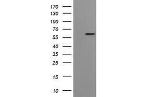 Western Blotting (WB) image for anti-Formiminotransferase Cyclodeaminase (FTCD) antibody (ABIN1496380)