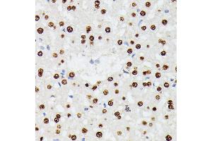 Immunohistochemistry of paraffin-embedded rat liver using HNRNPD antibody (ABIN7267632) at dilution of 1:100 (40x lens). (HNRNPD/AUF1 anticorps  (AA 1-306))