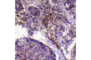 Immunohistochemistry (IHC) image for anti-Collagen, Type XVII, alpha 1 (COL17A1) (N-Term) antibody (ABIN3184002)