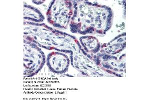 Immunohistochemistry with Human Placenta lysate tissue at an antibody concentration of 5. (SIN3A anticorps  (N-Term))