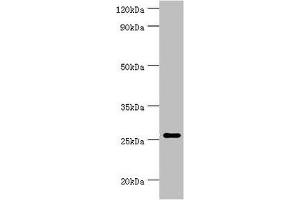 Western blot All lanes: Tumor necrosis factor ligand superfamily member 13 antibody at 10 μg/mL + Hela whole cell lysate Secondary Goat polyclonal to rabbit IgG at 1/10000 dilution Predicted band size: 28, 26, 25, 37, 23 kDa Observed band size: 28 kDa