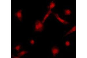 Immunofluorescent analysis of GRK2 staining in HeLa cells.