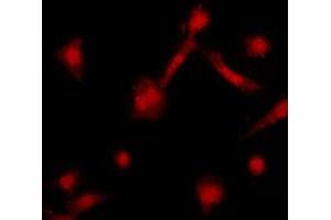 Immunofluorescent analysis of GRK2 staining in HeLa cells.