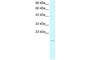 WB Suggested Anti-PFDN1 Antibody Titration:  5. (PFDN1 anticorps  (N-Term))