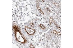 Immunohistochemical staining of human rectum with C1orf216 polyclonal antibody  shows strong positivity in endothelial cells at 1:10-1:20 dilution. (C1ORF216 anticorps)