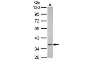 Image no. 1 for anti-Guanine Nucleotide Binding Protein (G Protein), alpha Transducing Activity Polypeptide 1 (GNAT1) (AA 37-350) antibody (ABIN1498484) (GNAT1 anticorps  (AA 37-350))