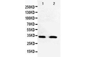 Anti-Cdk5 antibody, Western blotting Lane 1: HELA Cell Lysate Lane 2: JURKAT Cell Lysate (CDK5 anticorps  (C-Term))